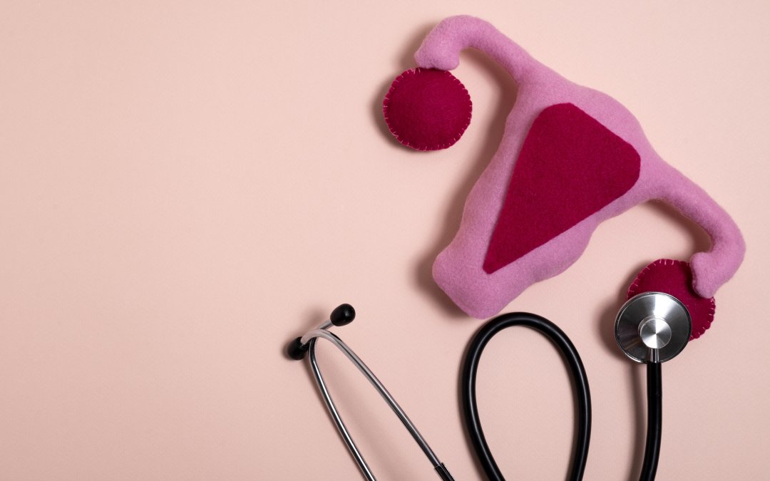 Endometriose: Sintomas, Diagnóstico, Tratamento e Cirurgia