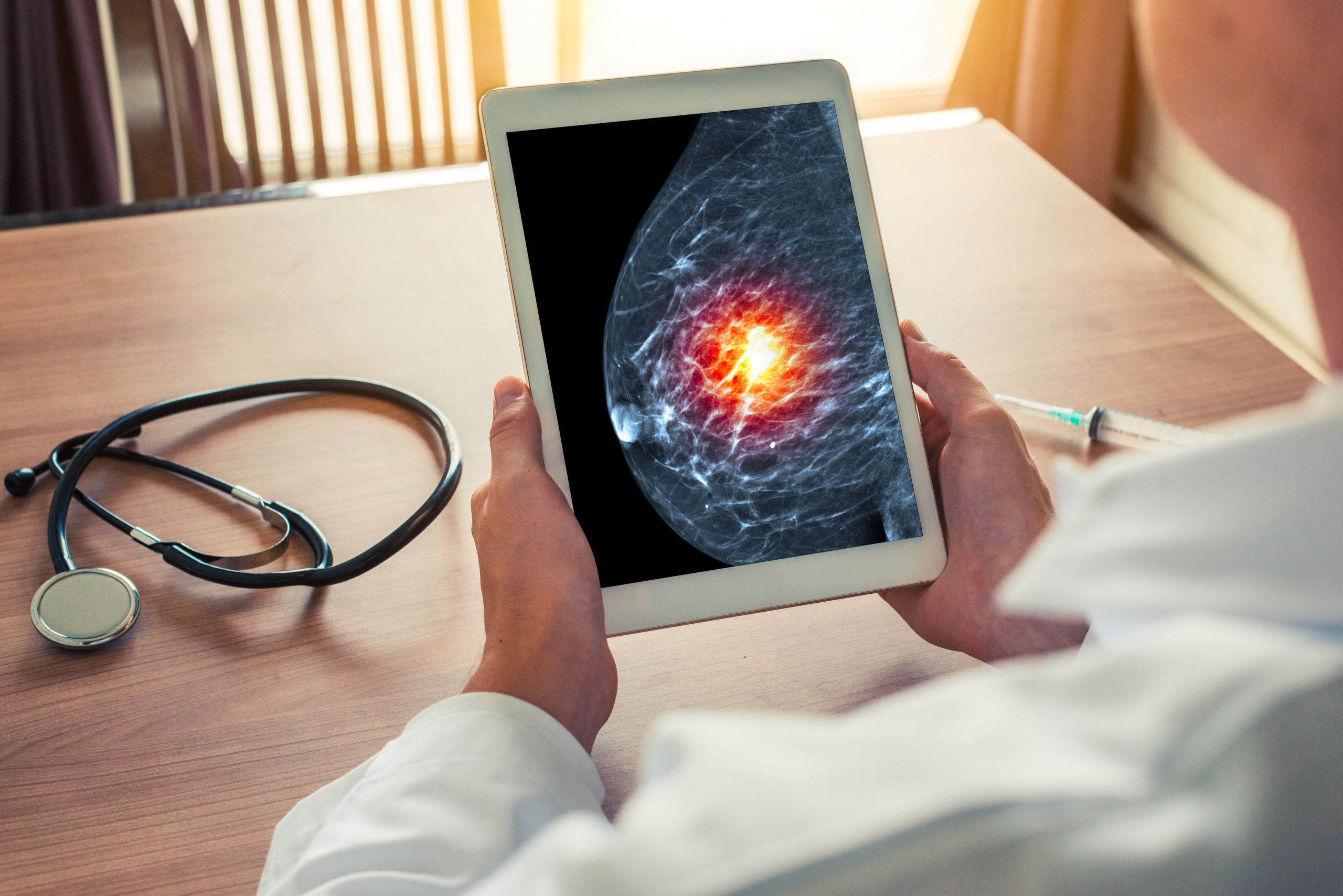 Doctor Holding A Digital Tablet With Xray Mammogram Skeleton. Breast Cancer Prevention