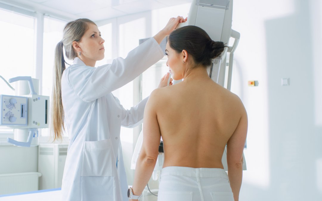 4 curiosidades: mitos e verdades sobre o exame de mamografia