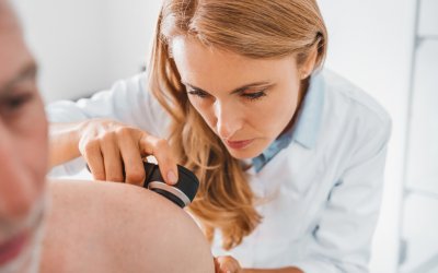 Vantagens da cirurgia micrográfica para retirada de câncer de pele