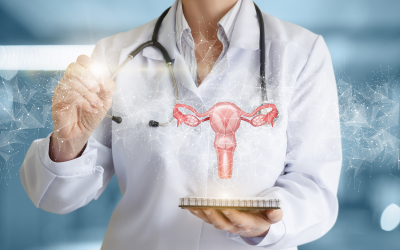 Miomas uterinos: como tratar e prevenir os sintomas?